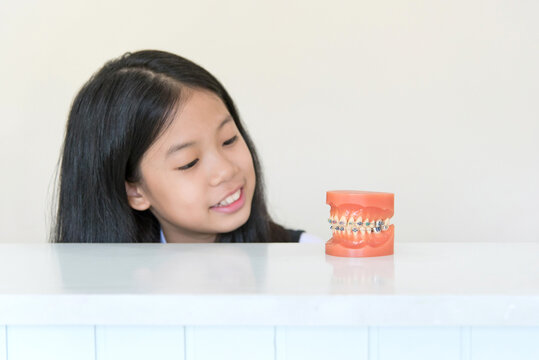 Artificial model of human jaw with dental braces in front of Asian pre teen girl with clean overbite tooth smiling in orthodontic office or clinic. Pediatric dentistry,education and prevention concept