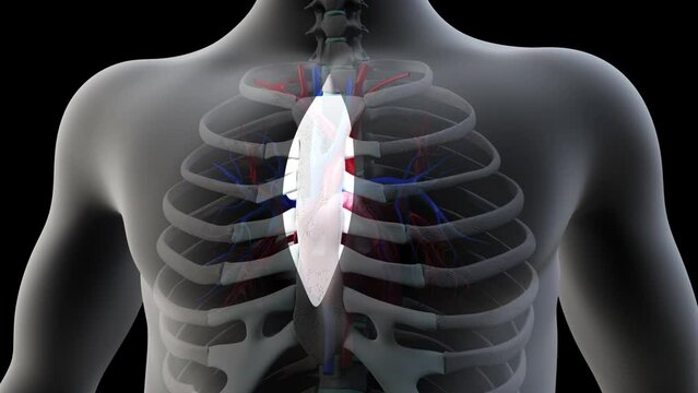 Heart Bypass Surgery