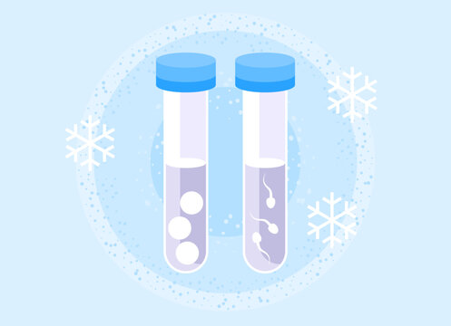 IVF freezing. Cryopreserved sperm. Frozen sperm utilization. Cryopreservation of genetic material. Reproductive technology. Artificial insemination. Female cell donation. Egg freezing. Egg donation