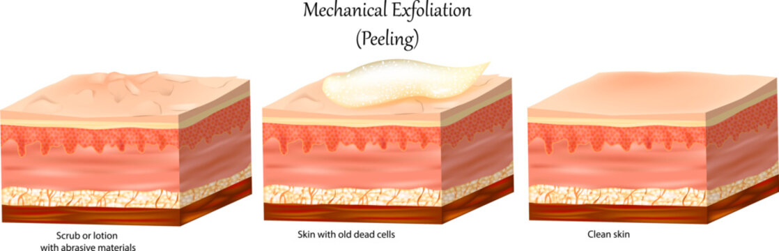 Mechanical Exfoliation or Peeling. Skin care with Face and Body.  Cross-section of a skin layers. Removal of the old dead cells and Clean skin.  