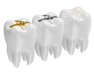 Teeth with restorations in on transparent background in 3d render 