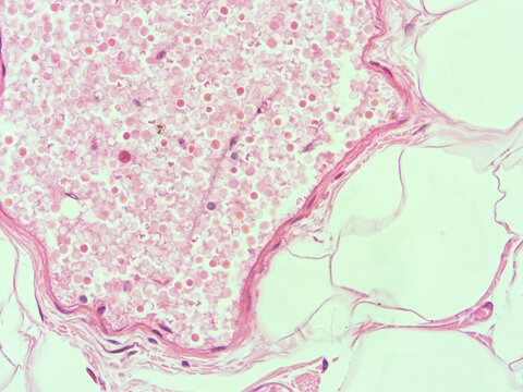 picture of histology human tissue with microscope from laboratory (not Illustration Designation)