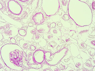 picture of histology human tissue with microscope from laboratory (not Illustration Designation)