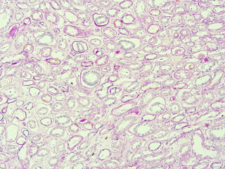 picture of histology human tissue with microscope from laboratory (not Illustration Designation)