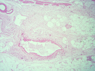 Obraz premium picture of histology human tissue with microscope from laboratory (not Illustration Designation)