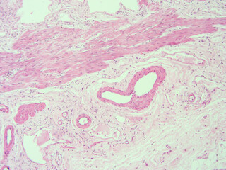 picture of histology human tissue with microscope from laboratory (not Illustration Designation)