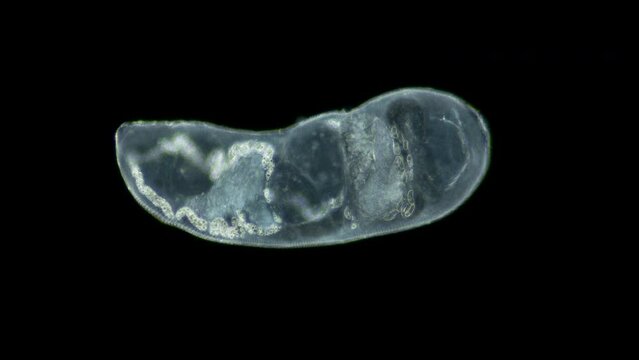 Parasitic Trematoda worm under microscope, possibly Brachyphallus crenatus. Stage of development of mature larva is Metacercaria. White sea