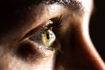 Macro of a clear female eye with keratoconus - obrazy, fototapety, plakaty