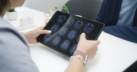 Female doctor sits in clinic cafe with patient. Healthcare specialist uses digital tablet, watches MRI or CT brain scan image, talks to person. Medical staff in hospital or medical center cafeteria.
