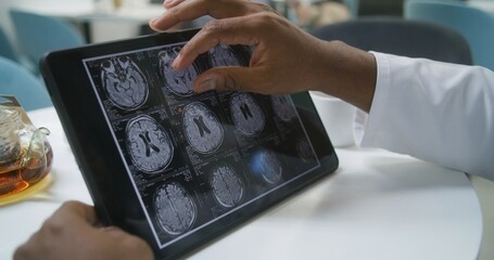 African American doctor flips through images of MRI or CT scan on digital tablet in clinic cafe. Professional medic examines brain scanning results of patient, drinks tea. Hospital canteen. Close up. © Framestock