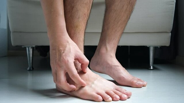 Men wear canvas shoes, he scratches legs and feet with itchy skin. Caused by of shoes	