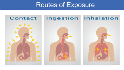 Vector Illustration for Routes of Exposure