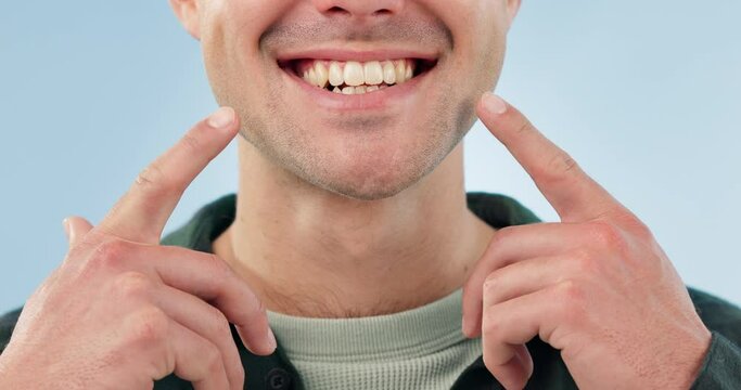 Smile, dental health and a person pointing to mouth for cleaning, Invisalign or braces on a blue background. Medical, healthcare and hands to show results or progress or teeth whitening and hygiene