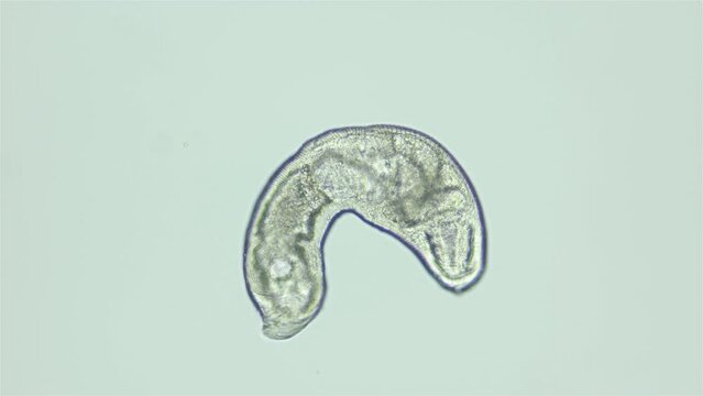 Parasitic Trematoda worm under microscope, possibly Brachyphallus crenatus. Stage of development of mature larva is Metacercaria. White sea