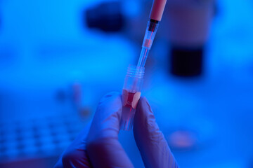 Naklejka premium Person selects biomaterial from test tube with a special pipette
