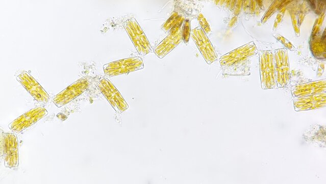 Marine diatom, Diatoma sp. 920x magnification. Fresh sample. Marine phytoplankton. Stacked photo 