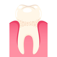 Vector strong tooth in gum on white background