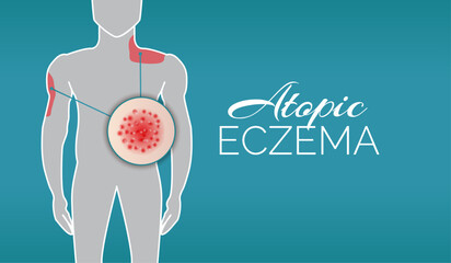 Atopic Eczema Background Illustration Banner with Man