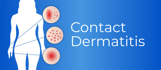 Contact Dermatitis Background Illustration