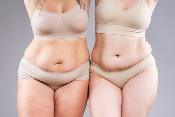 Tummy tuck, two fat women with flabby bellies on gray background, plastic surgery and body positive...