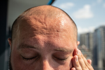 Forehead of overheated man becomes covered with sweat outdoors in hot climate in stuffy, windless...