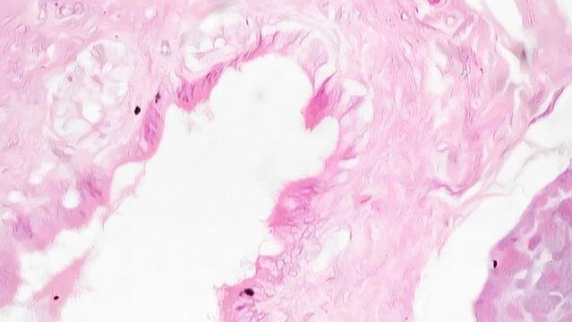 Human pancreas tissue in section filmed and magnified under microscope 400 on bright field background. Sample of digestive system organ in macro located in the abdomen. Research of people anatomy