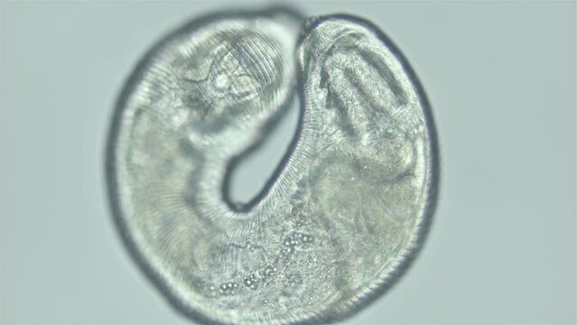 Parasitic Trematoda worm under microscope, possibly Brachyphallus crenatus. Stage of development of mature larva is Metacercaria. White sea