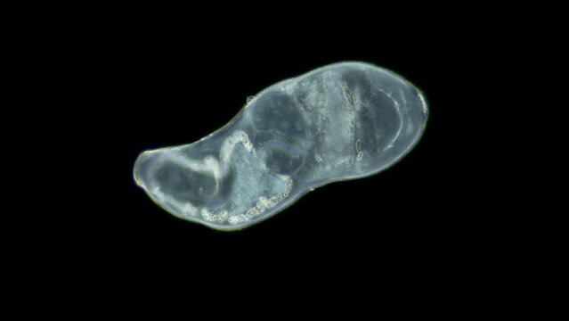 Parasitic Trematoda worm under microscope, possibly Brachyphallus crenatus. Stage of development of mature larva is Metacercaria. White sea