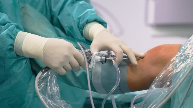 Surgeon Performing Knee Arthroscopy Operation in Hospital With Viewing Scope Instruments Inserted Into Knee Joint - Close up
