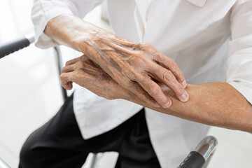 Hand of senior woman scratching her arm,itchy skin,dry skin problem,old elderly with short...