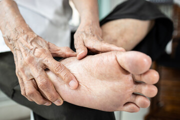 Diseases of Osteoarthritis or Rheumatoid Arthritis can affect the joints and foot pain,Peripheral...