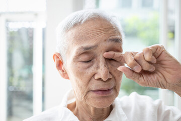Old elderly rubbing her eye,dry eyes,irritation,redness and itching,senior suffer from senile cataract,eye-related diseases,blurred clouded vision or double vision,sensitive to bright lights and glare - obrazy, fototapety, plakaty