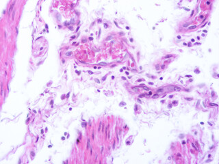 picture of histology human tissue with microscope from laboratory (not Illustration Designation)