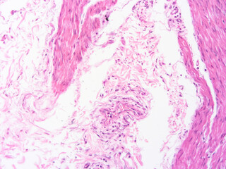 picture of histology human tissue with microscope from laboratory (not Illustration Designation)