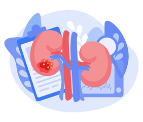Concept of kidney cancer. Check your kidney health. Vector illustration