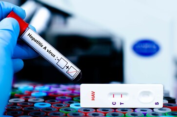 The patient positive tested for hepatitis A virus by rapid diagnostic test.