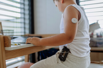 The diabetic boy doing homework, while wearing a continuous glucose monitoring sensor on his arm. - obrazy, fototapety, plakaty