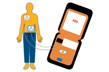 自動体外式除細動器 AED - obrazy, fototapety, plakaty