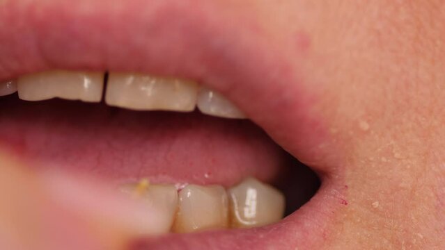 close-up of a woman picking her teeth with a wooden toothpick. dental hygiene after meals at home. taking care of dental health