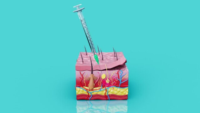 4K abstract animation of a subcutaneous injection.
