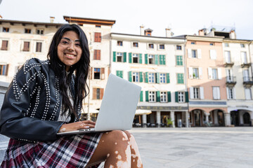 A young latina girl with vitiligo uses her laptop while sitting in the city center