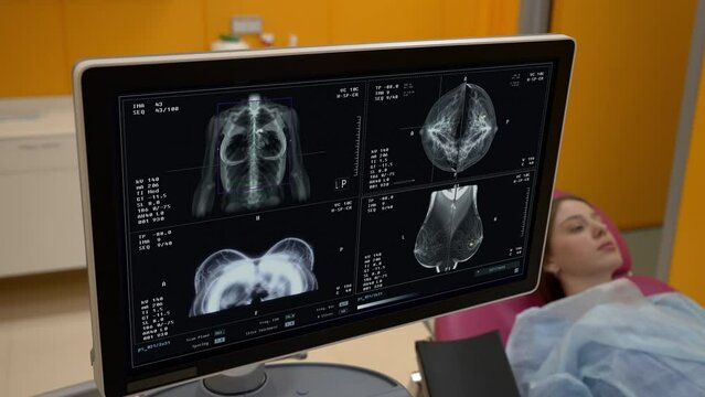 Medical diagnostic test of the female patients chest. Medical diagnostic test scanning through the breast. Medical diagnostic test identifying the cancer cells in the patients breast tissue.