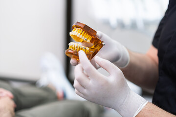 Dentist with latex gloves holding human jaws model with installed metal dental braces for teeth...