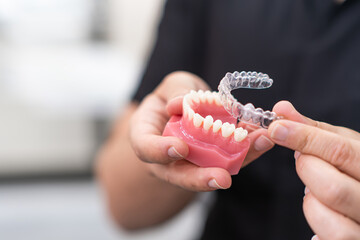 Orthodontist holding lower human jaw model and transparent aligners in modern clinic specialist...