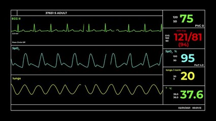 CGI video of screen of medical equipment with integrated systems of monitoring vital parameters