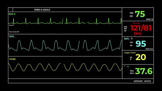 CGI video of screen of medical equipment with integrated systems of monitoring vital parameters
