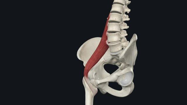 The psoas muscle is a paraspinal muscle located deep in the body, very close to the spine and the brim of the lesser pelvis