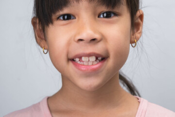 Close-up of cute young girl smiling wide, showing empty space with growing first front teeth. Little girl with big smile and missing milk teeth. Dental hygiene concept - obrazy, fototapety, plakaty