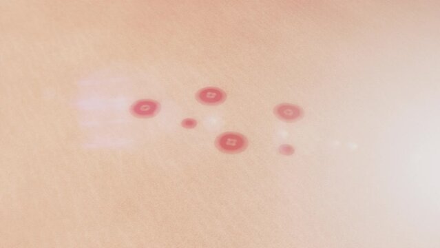 3D Animation Cure Serum Acne Repair Effect On Skin - Elegance Render Skincare