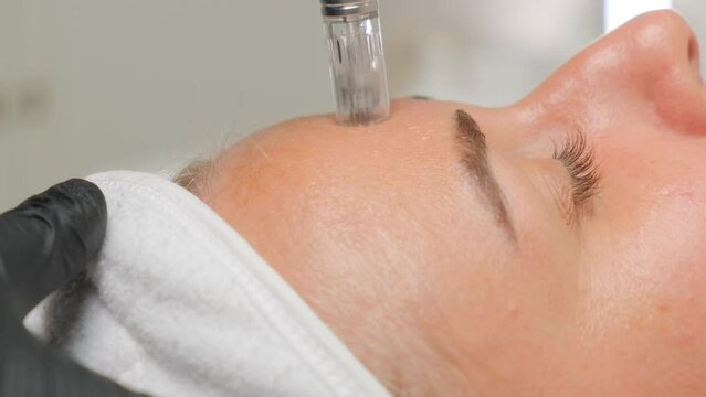 Close-up portrait of a beautiful aged woman during microneedling with dermapen from a beautician.